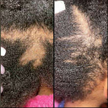 Load image into Gallery viewer, Kids Hair Growth Oil